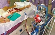 L'Hospital La Fe és el primer centre espanyol a aconseguir els 500 implants amb el mètode ECMO