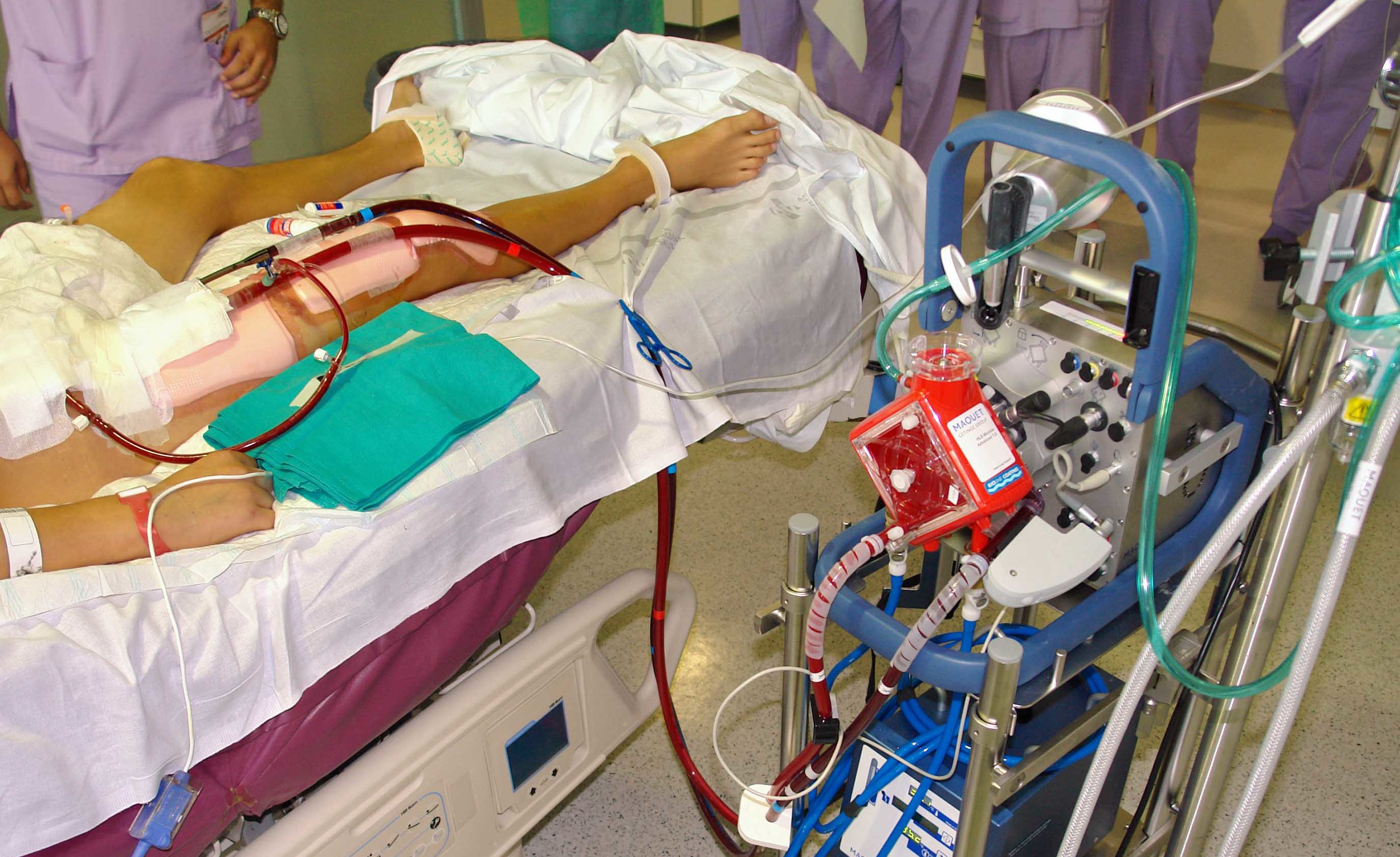 L'Hospital La Fe és el primer centre espanyol a aconseguir els 500 implants amb el mètode ECMO