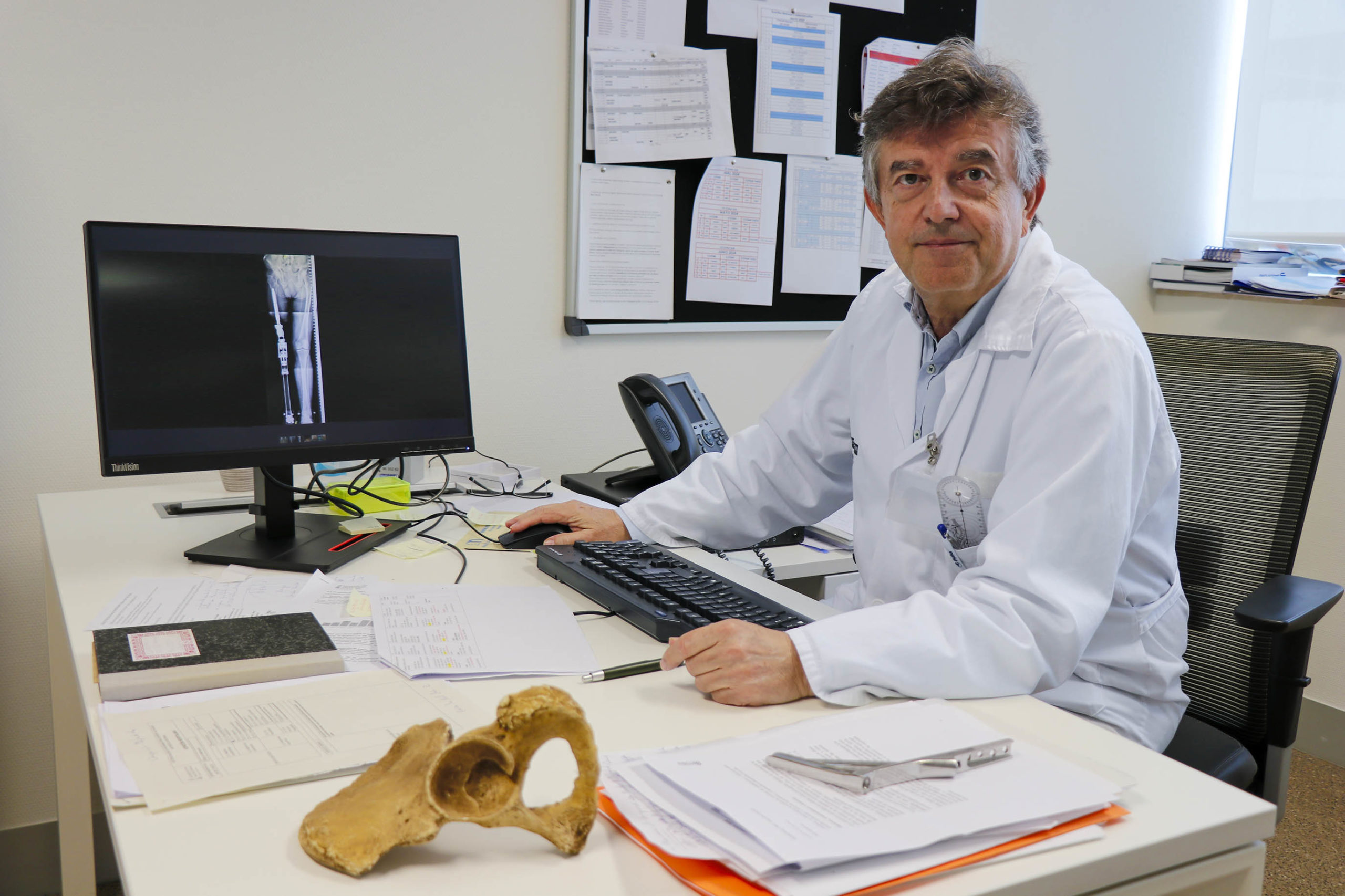 La Fe realitza amb èxit dos cirurgies d'osteointegració de membres inferiors en un sol pas
