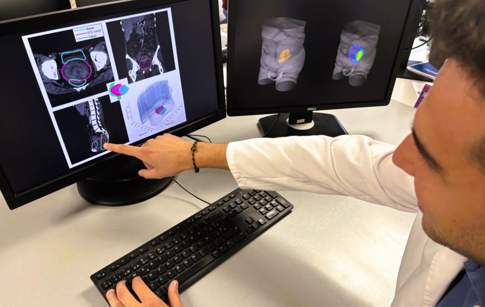 Ivace+i finança un projecte per a millorar la precisió dels tractaments de radioteràpia que combaten el càncer