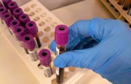 La CV compta amb més de 43.500 donants de medul·la òssia i amb prop de 5.000 unitats de cordó umbilical