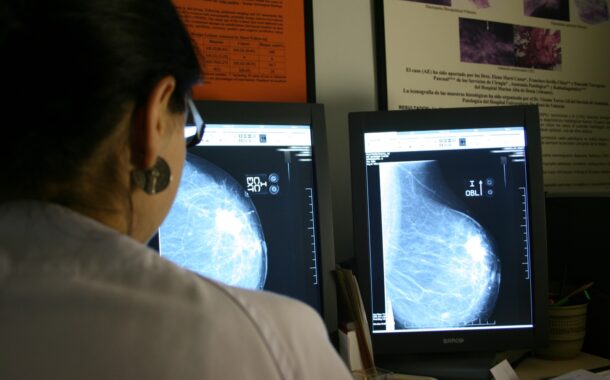 Sanitat examina des de gener a més de 311.000 dones amb el cribratge de càncer de mama