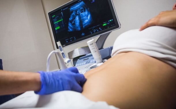 Sanitat establix un protocol comú per a millorar el diagnòstic genètic de les malformacions fetals